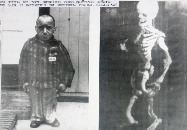 Dicembre 1942 – Una delle tante vittime di numerosi esperimenti pseudo-scientifici compiuti nel carcere dei lager, e poi mummificata.